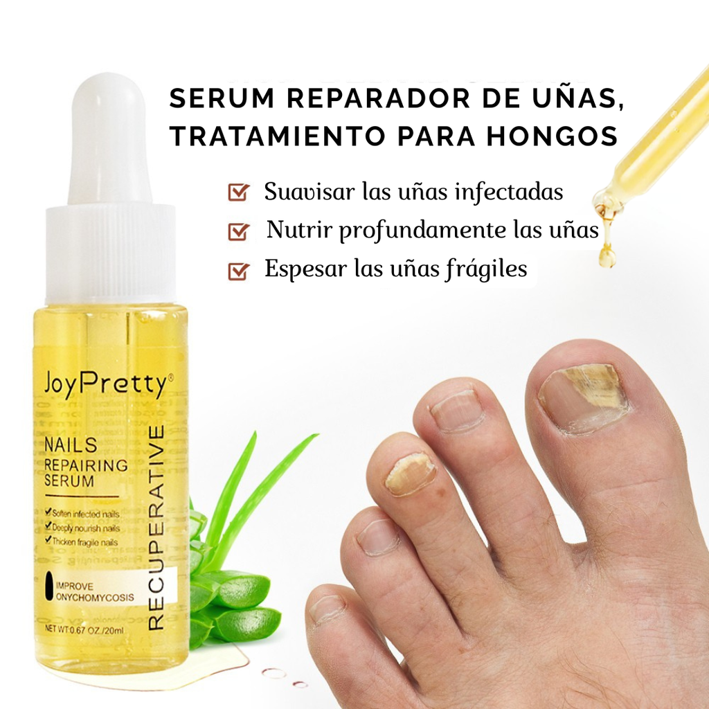 JoyPretty™ ¡Elimina los hongos de tus uñas de raíz!
