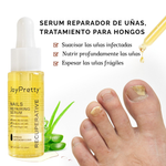 JoyPretty™ ¡Elimina los hongos de tus uñas de raíz!