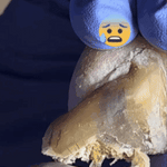 JoyPretty™ ¡Elimina los hongos de tus uñas de raíz!